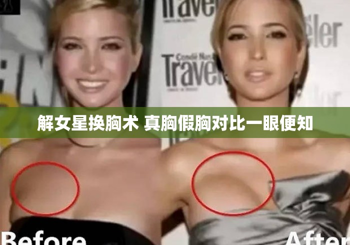 解女星换胸术 真胸假胸对比一眼便知，女星换胸术真假对比