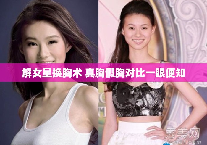 解女星换胸术 真胸假胸对比一眼便知