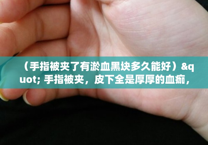 （手指被夹了有淤血黑块多久能好）" 手指被夹，皮下全是厚厚的血痂，这能长好吗