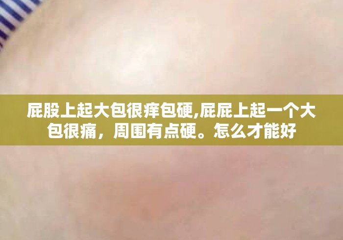 屁股上起大包很痒包硬,屁屁上起一个大包很痛，周围有点硬。怎么才能好