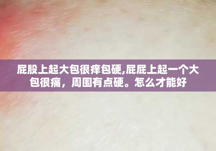 屁股上起大包很痒包硬,屁屁上起一个大包很痛，周围有点硬。怎么才能好