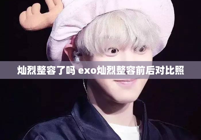 灿烈整容了吗 exo灿烈整容前后对比照
